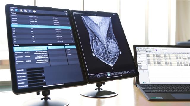 資策會與商之器合作之iPad版行動乳篩助理