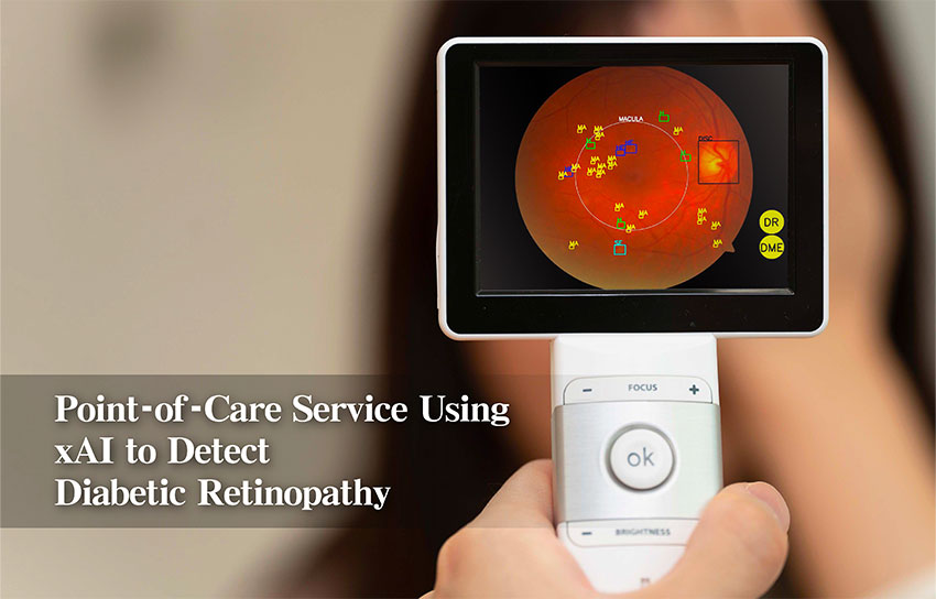 眼部醫學影像輔助診斷技術圖片