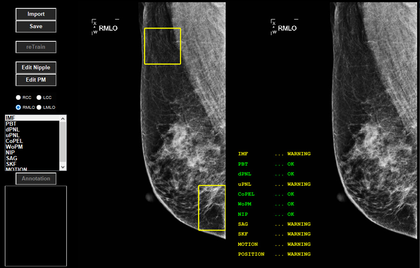 Mammography Quality Evaluation (MQE)