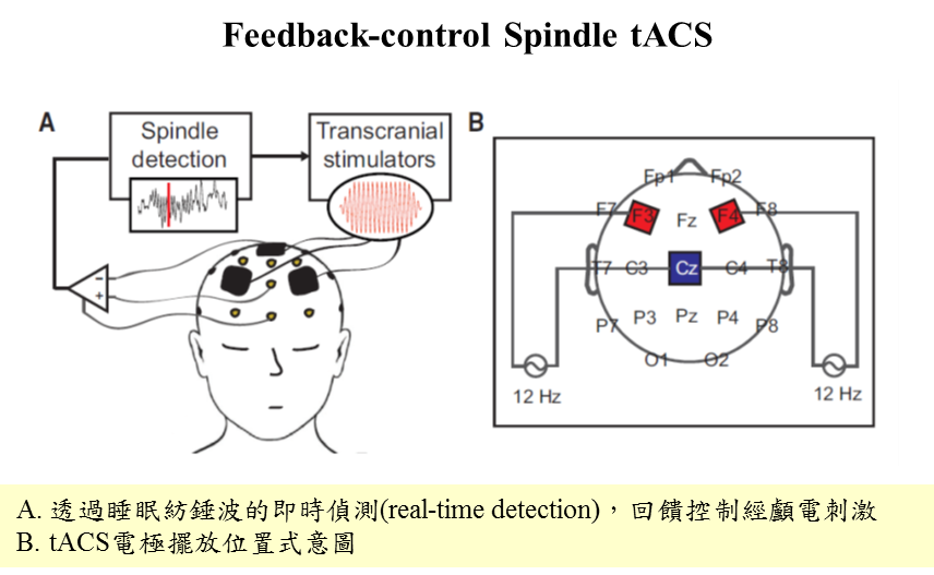 圖2 顱電刺激技術示意圖