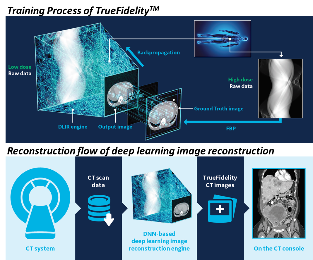 圖2　 GE Healthcare 之CT造影重建深度學習演算法的開發與應用