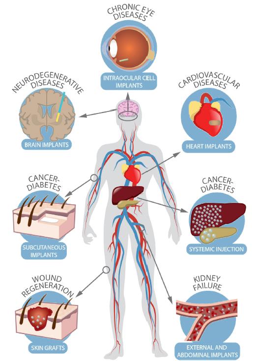 圖3 活細胞植體可運用之疾病治療領域