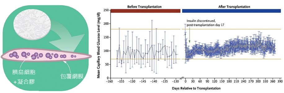 圖2 活細胞植體可較穩定的調控第一型糖尿病患者之血糖