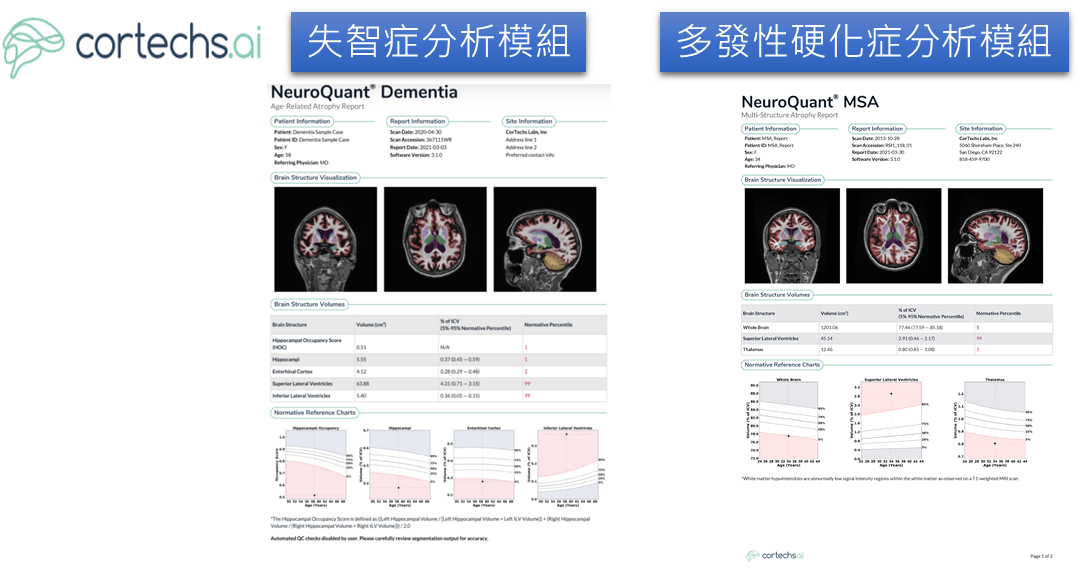 圖6 Cortechs.ai開發之腦部MRI分析軟體：NeuroQuant