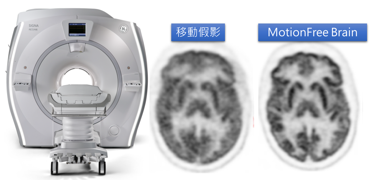 圖5 GE開發之之PET/MR AI: MotionFree Brain (機型 SIGNA™ PET/MR)