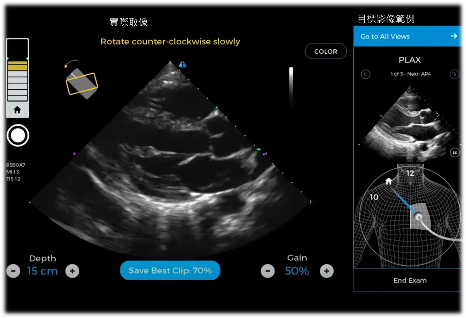 圖3　 Caption Health的AI引導心臟超音波造影平台Caption Guidance