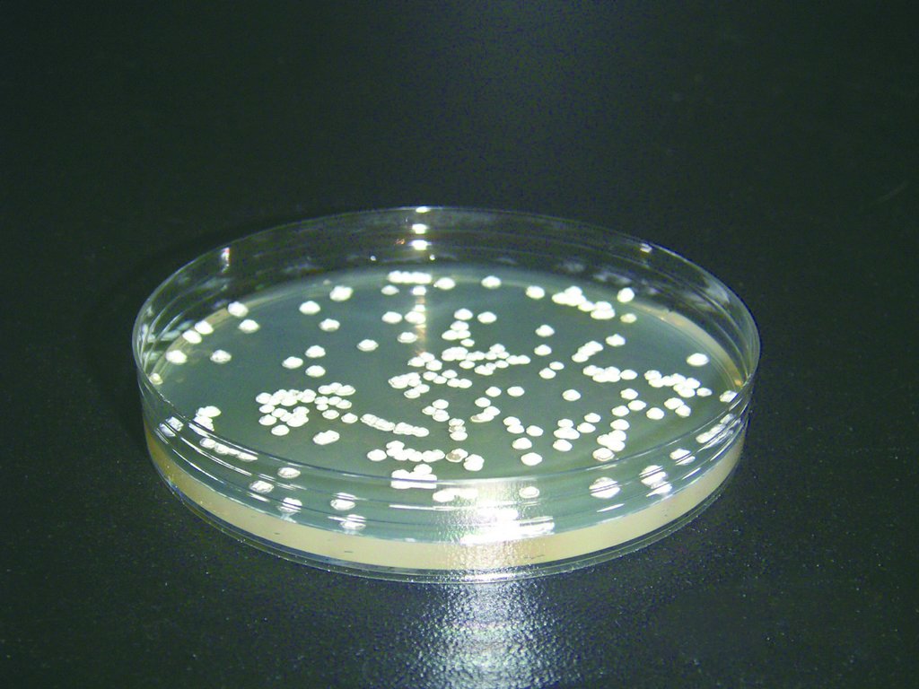 Natamycin高產量菌株的篩選，菌株於培養皿上長出的菌落